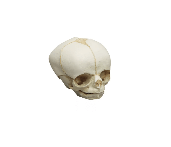 Fetusschädel, 30 Wochen – anatomisches Modell zur Darstellung der Schädelentwicklung im Mutterleib - Erler - Zimmer