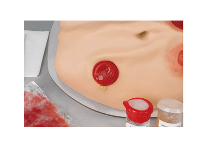 Kompletter Stoma - Simulator - Erler - Zimmer