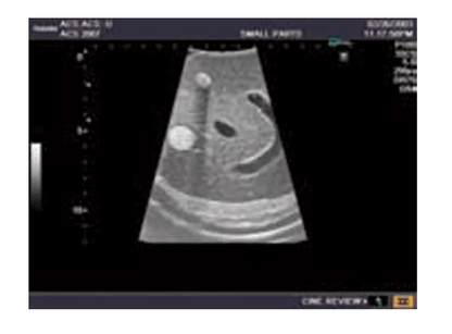 Ultraschall - Modell für Sonografie - Erler - Zimmer