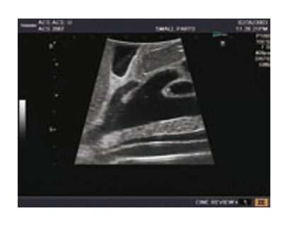 Ultraschall - Modell für Sonografie - Erler - Zimmer