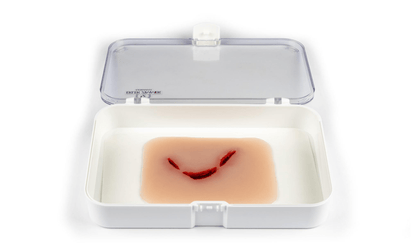 Wundmoulage Schnittwunde Flasche - Erler - Zimmer