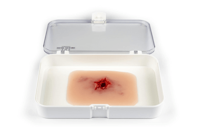 Wundmoulage Schuß Austrittswunde - Erler - Zimmer