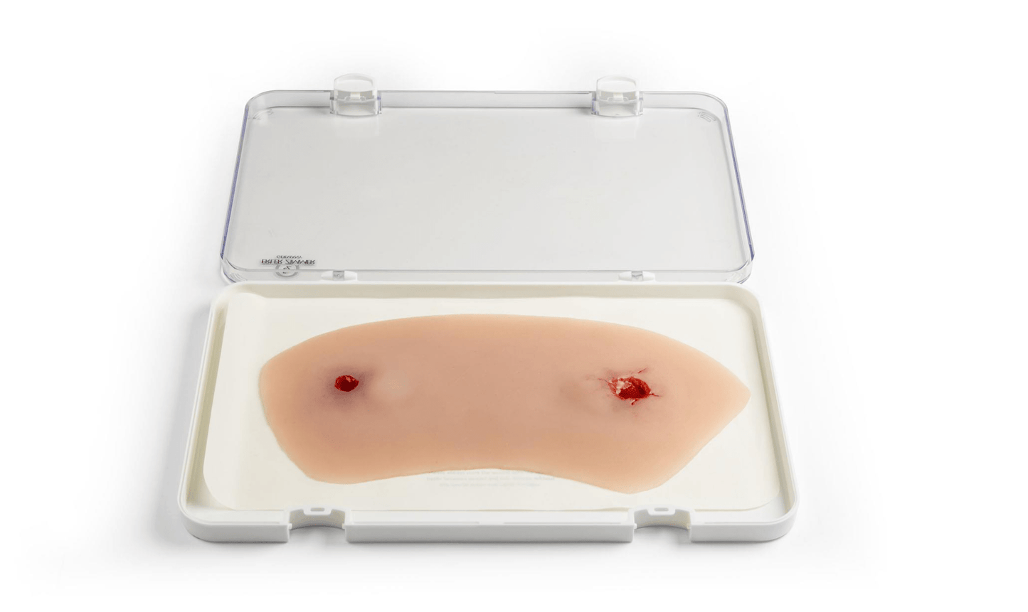 Wundmoulage Schuß Sprunggelenk - Erler - Zimmer