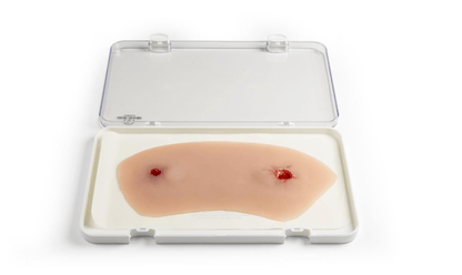 Wundmoulage Schuß Sprunggelenk - Erler - Zimmer