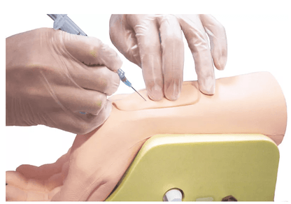 Handgelenk zur Arterienpunktion - Erler - Zimmer