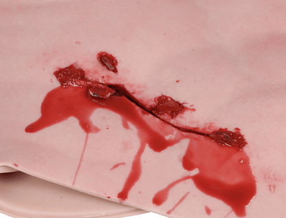 Erler-ZimmerBrusthaut mit Schrapnellwunde zum UmschnallenDocMed GmbH
