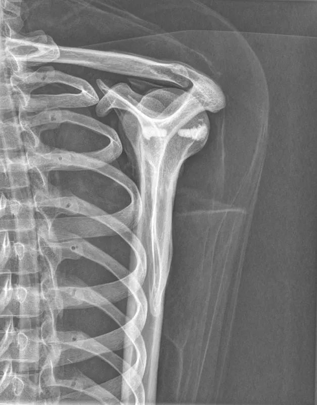 Erler-ZimmerGanzkörper RöntgenphantomDocMed GmbH