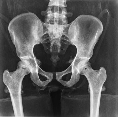 Erler-ZimmerGanzkörper RöntgenphantomDocMed GmbH