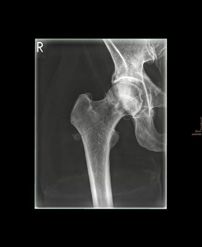 Erler-ZimmerGanzkörper RöntgenphantomDocMed GmbH