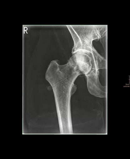 Erler-ZimmerGanzkörper RöntgenphantomDocMed GmbH