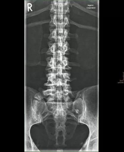 Erler-ZimmerGanzkörper RöntgenphantomDocMed GmbH