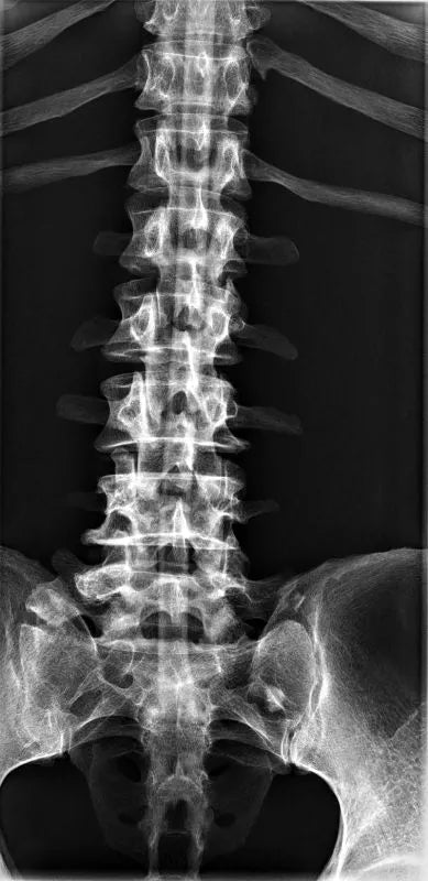 Erler - ZimmerGanzkörper RöntgenphantomDocMed GmbH