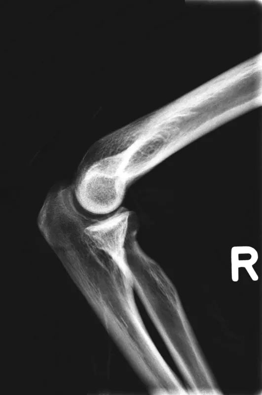 Erler - ZimmerGanzkörper RöntgenphantomDocMed GmbH