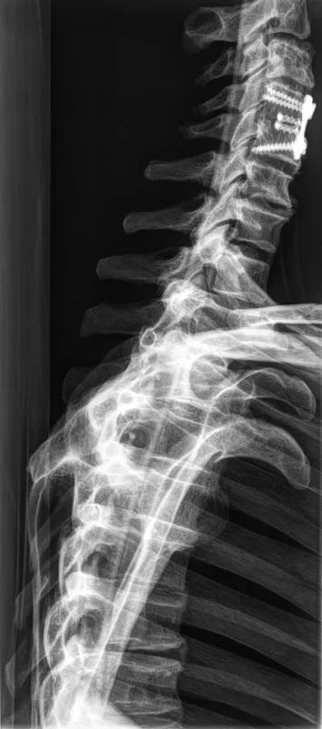 Erler - ZimmerGanzkörper RöntgenphantomDocMed GmbH